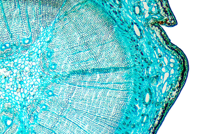 Microsection of an evergreen conifer 